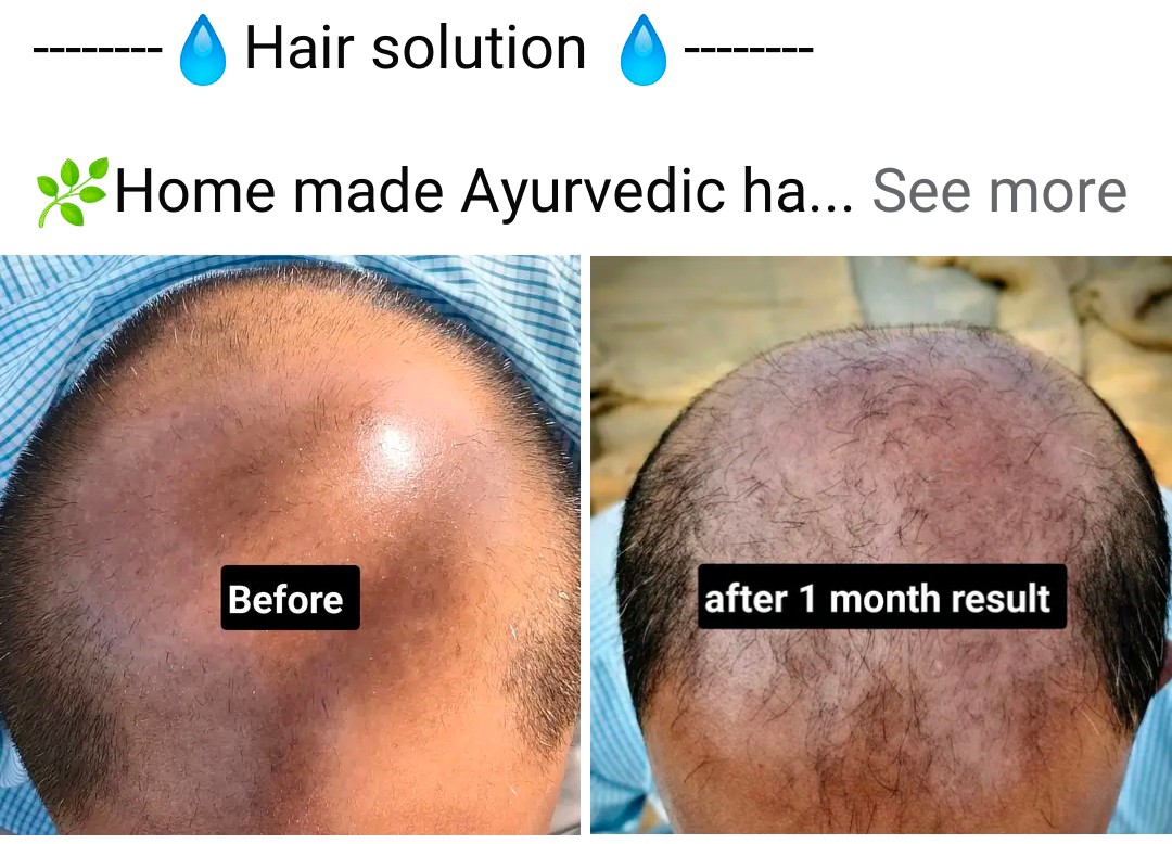 Hair solution 